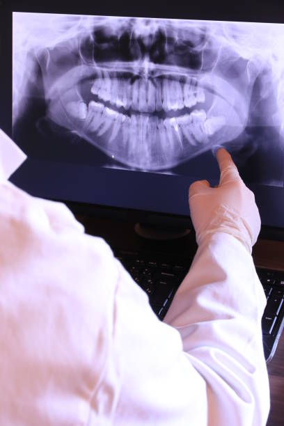 Best Emergency Denture Repair in Collins, MS